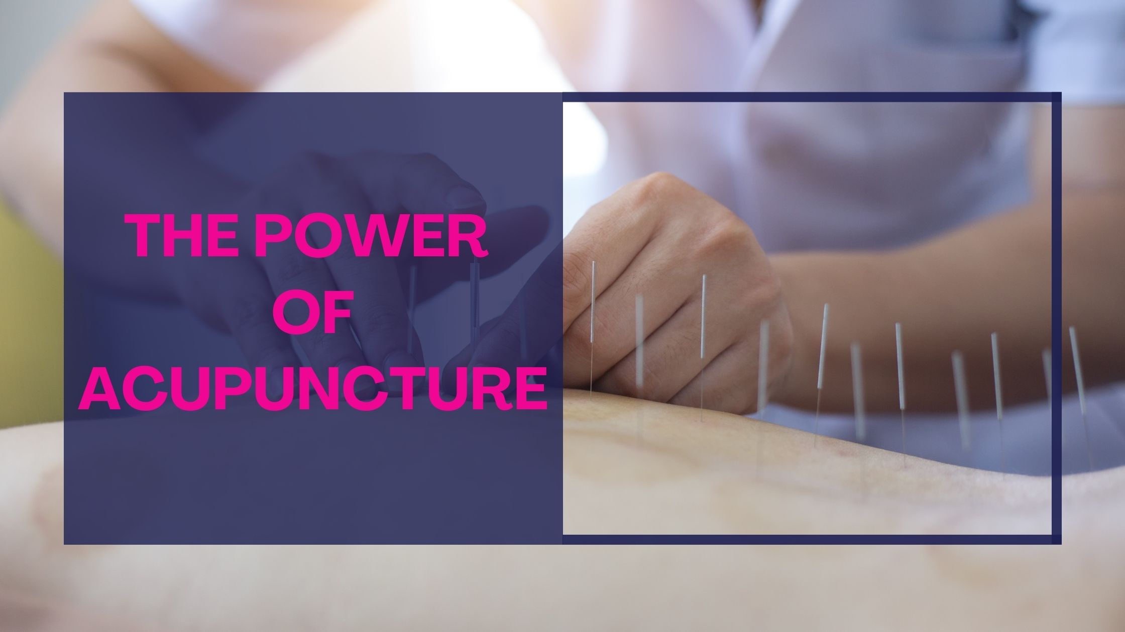 The Power of Acupuncture